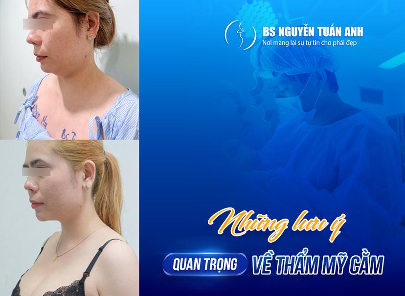 Cằm