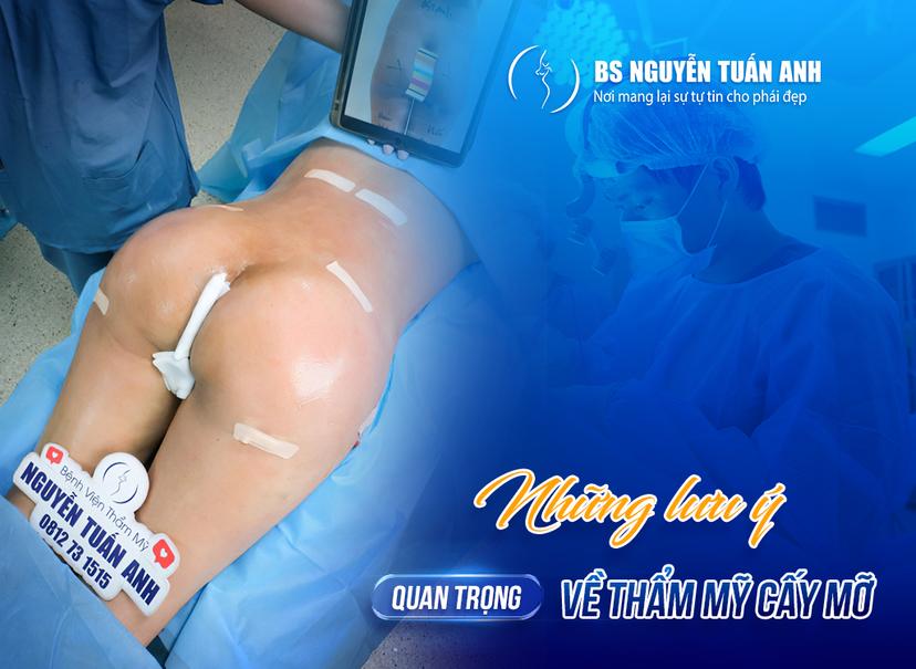 Cấy mỡ