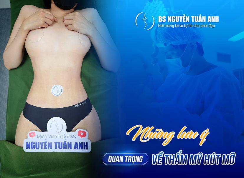 Hút mỡ