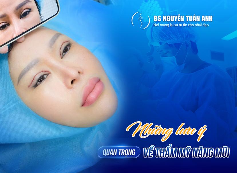 Mí mắt