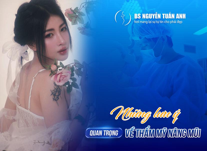 Nâng mũi