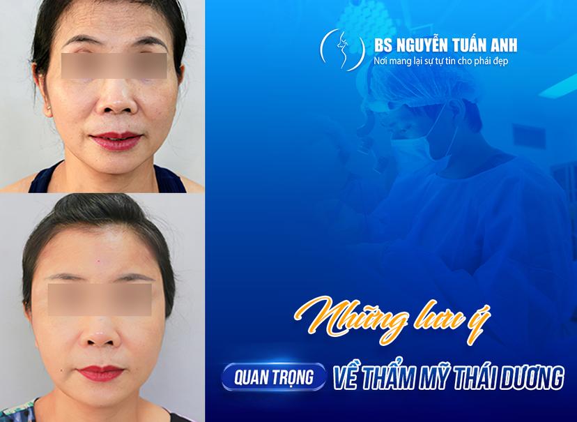 Thái dương